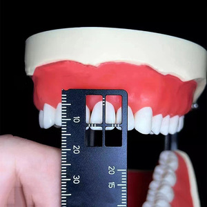 Regla de Medición Vertical Graduada de Doble Cara para Técnico Dental, Instrumento para Espaciado de Dientes, Instrumento de Raíz, Instrumentos Quirúrgicos Dentales - Product Image 1