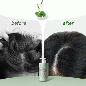 Etiqueta privada OEM Romero champú para el cabello para hombres 2 en 1 champú - Product Image 4