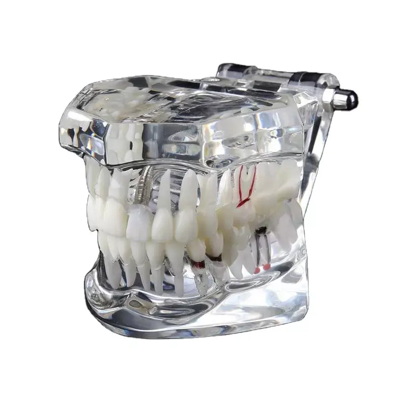 Model anatomi gigi, kualitas tinggi model pembelajaran 32 gigi model demonstrasi standar
