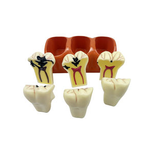 Modèles de comparaison des caries (4 fois grandis), Modèle de dents décomposées pour l'enseignement, la <span class=keywords><strong>recherche</strong></span> et l'étude en dentisterie pour étudiants - Product Image 4