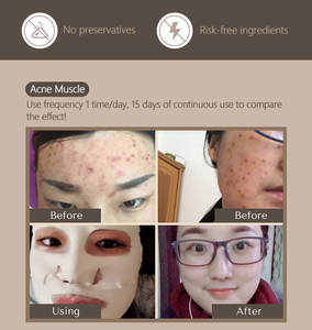 โคลนภูเขาไฟเดดซีลอกหน้าเบนโทไนท์,มาส์กหน้าทำความสะอาดล้ำลึกดินเหนียวขาว - Product Image 5