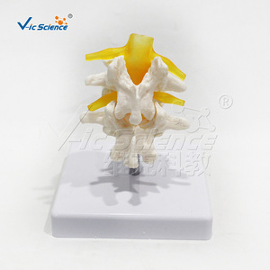 Modelo de vértebra humana de dos segmentos, material de PVC de alta precisión, estructura precisa, para demostración de patología en universidades - Product Image 3