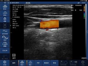 Sonda Inalámbrica Doppler a Color DMU86, Escáner de Ultrasonido Inalámbrico Portátil, Sonda Lineal con el Mejor Precio - Product Image 6