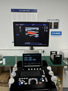 Ecógrafo Médico a Color para Embarazo, Tipo Carrito, Ultrasonido <span class=keywords><strong>Doppler</strong></span> 3D 4D - Product Image 6