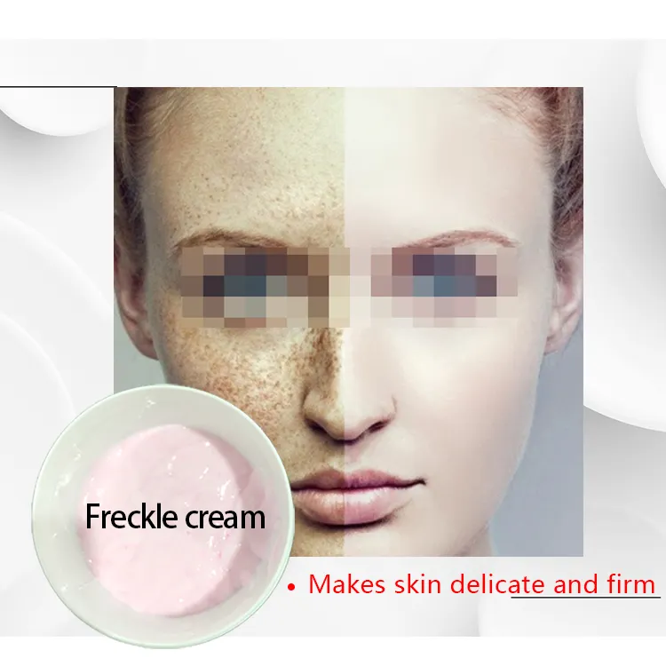 Ready To Rebrand Dark Spot Freckle Cream Scar Removing Cream Private Label Melasma Treatment Whitening Cream Sold By KG