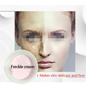 Ready To Rebrand Dark Spot Freckle Cream Scar Removing Cream Private Label Melasma Treatment Whitening Cream Sold By KG