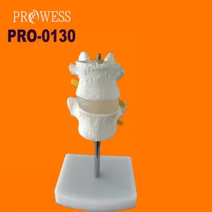 PRO-0130 preço de fábrica Alta qualidade e exibição clara esqueleto combinação vértebras lombares normais (duas seções)