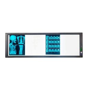 Visionneuse de <span class=keywords><strong>film</strong></span> de radiographie de LED de machine de balayage de tomodensitométrie d'hôpital de source d'énergie électrique pour l'analyse de <span class=keywords><strong>film</strong></span> de rayon X - Product Image 3