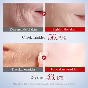Tonico Viso Anti-rughe al Collagene di Lumaca SADOER OEM Etichetta Privata Cura della Pelle Coreana Essenza Rassodante per Schiarire le Macchie Scure - Product Image 4