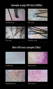 Analizador de Piel de 3 Espectros 50X, Análisis de las Capas de la Piel, Inflamación/Resequedad/Enrojecimiento - Product Image 5