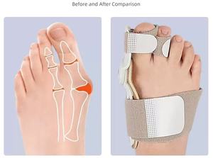 Attelle pour <span class=keywords><strong>Hallux</strong></span> <span class=keywords><strong>Valgus</strong></span> à Deux Trous, Redresseur d'<span class=keywords><strong>Hallux</strong></span> <span class=keywords><strong>Valgus</strong></span>, <span class=keywords><strong>Correcteur</strong></span> de <span class=keywords><strong>Hallux</strong></span> <span class=keywords><strong>Valgus</strong></span>, Réglable, Redresseur de Pouce - Product Image 4