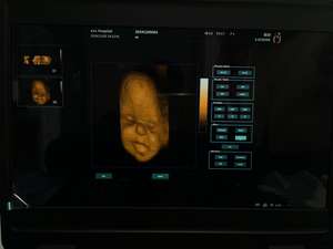 Ecógrafo Doppler Color Portátil para Hospital Veterinario, Mejor <span class=keywords><strong>Precio</strong></span>, Máquina <span class=keywords><strong>de</strong></span> Ultrasonido a Color 3D 4D - Product Image 5