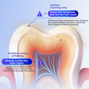 Dentifrice au fluorure Olaflur, anti-caries, blanchissant, élimine les taches de thé, de café et de fumée, OEM ODM, dentifrice personnalisé pour usage domestique - Product Image 3