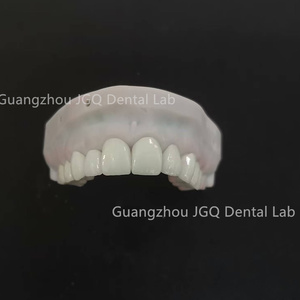 Buen <span class=keywords><strong>Precio</strong></span> Chapa Dientes Restauración <span class=keywords><strong>de</strong></span> porcelana Blanqueamiento dental Preparación mínima Carillas <span class=keywords><strong>dentales</strong></span> - Product Image 3