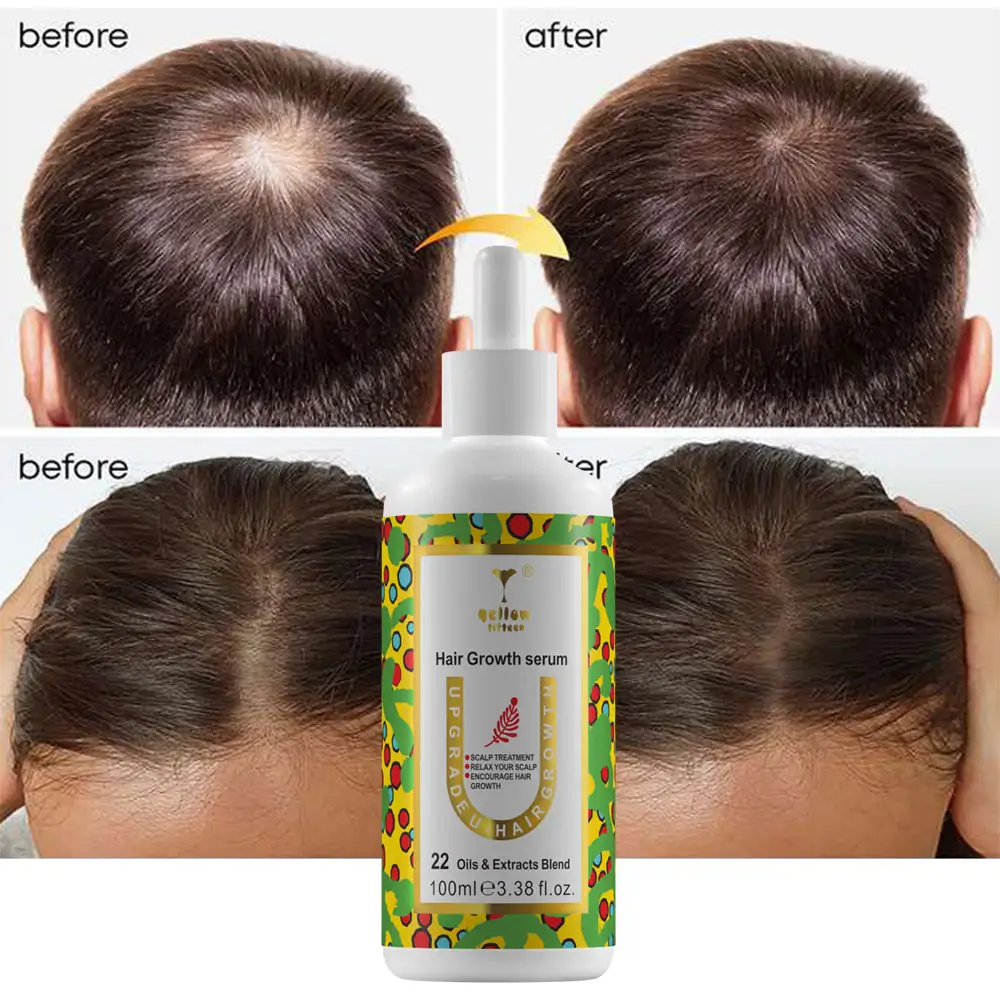 Organic essential oil treatment products private label hair care hair loss treatments for hair growth men and women