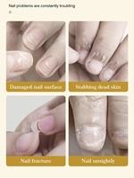 Sérum Réparateur Efficace et Puissant pour Ongles en 7 Jours, Solution Nourrissante pour Ongles Abîmés, Traitement Naturel des Ongles de Bonne Qualité