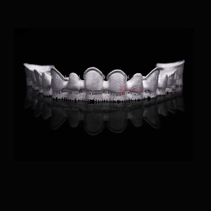 Tecnologia di stampa Laser 3D per cliniche dentali personalizzate corone e ponti in Cina laboratorio dentale - Product Image 4