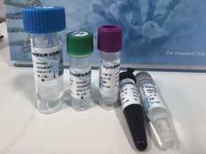 Nipah Virüsü Nükleik Asit Tespit Kiti (Floresan PCR) 200 Kopya/mL Ultra Hassasiyetli - Product Image 1