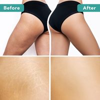 Brosse pour le corps à sec pour le drainage lymphatique et la cellulite-Bruits naturels pour le brossage humide et sec