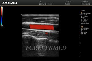 Ecógrafo Portátil Doppler Color 4D 5D, Máquina de Ultrasonido Digital Completa - Product Image 4