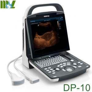 Mesin Ultrasound <span class=keywords><strong>Mindray</strong></span> <span class=keywords><strong>DP</strong></span>-10 Hitam dan Multi, Mesin Ultrasound <span class=keywords><strong>Mindray</strong></span>, Mesin Ultrasound Portabel - Product Image 4