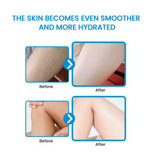 Lozione riparatrice della barriera cutanea QBEKA, crema idratante quotidiana per il corpo per pelli <span class=keywords><strong>molto</strong></span> secche e sensibili, crema per <span class=keywords><strong>viso</strong></span> e corpo - Product Image 6