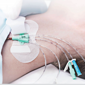 Dispositifs médicaux Accessoires médicaux blancs CE Dispositifs et fournitures médicaux EOS transparents Dispositif de pansement pour plaies - Product Image 1