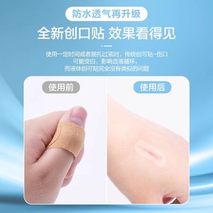 Cofoe Liquid Band-Aid 10ml Spray <b>Waterproof</b> Breathable Medical Wound <b>Dressing</b> For Children - Product Image 5