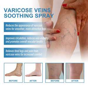 Оптовая продажа: спрей для ухода за ногами 30 мл для разглаживания отеков и лечения кровеносных сосудов - Product Image 4