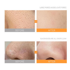 Mascarilla de barro de limpieza de poros de etiqueta privada OEM Mascarilla de arcilla purificadora de control de aceite con ácido salicílico Jojoba Purslane para espinillas de acné - Product Image 3