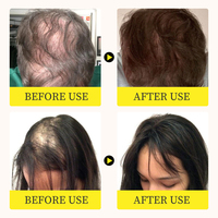 Essence de croissance des cheveux, développement des cheveux, sérum de croissance des cheveux nourrissant et hydratant, tonique capillaire en gros et sur mesure