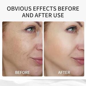 Collageen Multifunctionele Schoonheidsbalsem Stok Hydraterende Hydraterende Herstellende Lip Gezichtshuid Natuurlijke Ingrediënten Draagbare Lippenbalsem - Product Image 6