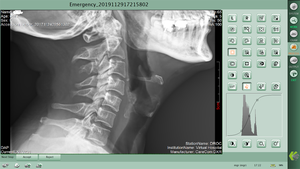 Détecteur à écran plat numérique DR FPD X-ray Imaging 14X17 - Product Image 5