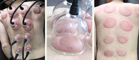 FARSLIM 2023 Machine d'amélioration du sein sous vide levage des fesses hanche ascenseur Massage du sein corps ventouses grandes tasses pour un usage domestique