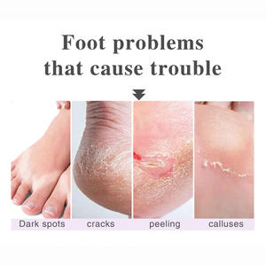 Mascarilla Exfoliante Natural para <span class=keywords><strong>Pies</strong></span>, Elimina Suavemente la Piel Muerta y los Callos, <span class=keywords><strong>Pies</strong></span> Suaves y Tersos como de Bebé - Product Image 3