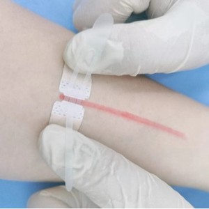 Steri Strips Skin Tone Wound Closure Tape Non-Woven Fabric Medical Adhesive For Wound Fixation - Product Image 1