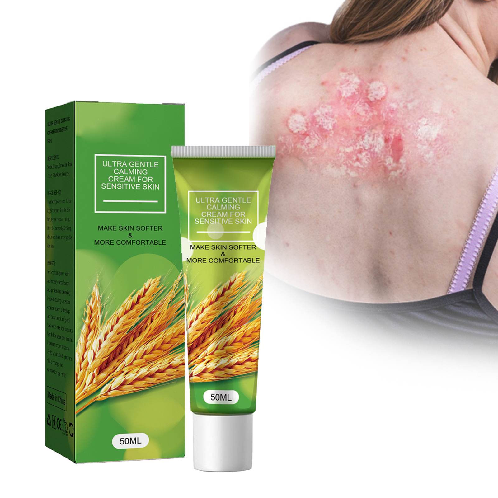 Psoriasis Ointment Relieves Itching and Repairs Redness and Itching Skin Tinea Manus and Pedis and Itching Ointment.