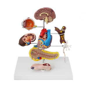Modèle médical de diabète 8 pièces globe oculaire coeur rein vaisseau sanguin pied modèle d'anatomie détachable affichage du diabète aide à la pathologie - Product Image 2