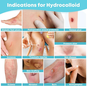 Rollo de Hidrocoloide Adhesivo Transparente, Sin Látex, de Grado Médico, para el Cuidado de Acné y Ampollas, Venta al Por Mayor - Product Image 3