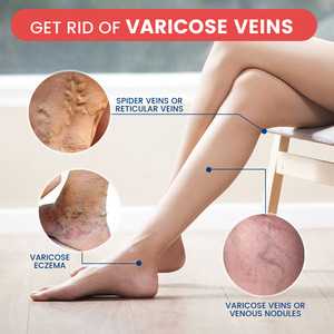 Parches para Várices, Alivian las Várices en las Piernas, Eliminan las Várices, Crema para la Salud de las Piernas - Product Image 5