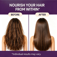 Capsules pour la croissance des cheveux avec biotine, favorisent des cheveux plus épais, réduisent la chute des cheveux pour des cheveux, une peau et des ongles sains, 120 capsules