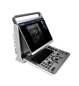 Draagbare Veterinaire Echografie <span class=keywords><strong>Machine</strong></span> Voor Dierlijke Diagnose <span class=keywords><strong>Doppler</strong></span> Kleur Diagnostische Veterinaire Echografie - Product Image 4