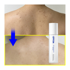 [Offon] giữ bình tĩnh và làm mát cơ thể nhẹ nhẹ dưỡng ẩm cơ thể huyết thanh cho da khô nhạy cảm cứu trợ và sửa chữa - Product Image 1