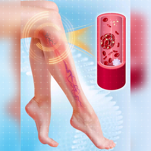 Salep Varises untuk Meredakan Nyeri Kaki dan Mengobati Vaskulitis - Product Image 2