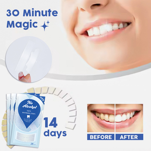 Zahn aufhellung streifen White Tooth Dental Kit Mundhygiene-Pflege streifen für Bleaching-Streifen für falsche Zahn furniere - Product Image 3