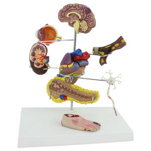 Modelo de cateterización coronaria, Uman - Product Image 5