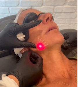 Лазерный липолиз 980 нм, длина волны 1470 нм - Product Image 2