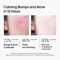 Masque d'argile exfoliant personnalisé contre l'acné, à l'acide salicylique, à la niacinamide et à la centella asiatica, masque nettoyant pour le visage, éliminateur de points noirs