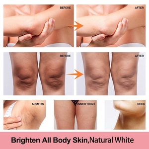 Lotion éclaircissante pour le corps jambes végétaliennes aisselles genou coude parties intimes éliminer les taches brunes soins de la <span class=keywords><strong>peau</strong></span> à la mélanine - Product Image 3