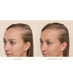 ETRUN ALISA Marque privée Sérum de croissance des cheveux à la biotine Réduit la perte Fournit une hydratation instantanée avec du cuir chevelu <span class=keywords><strong>Dermaroller</strong></span> - Product Image 6